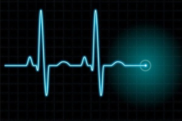 A heart rate monitor signal.